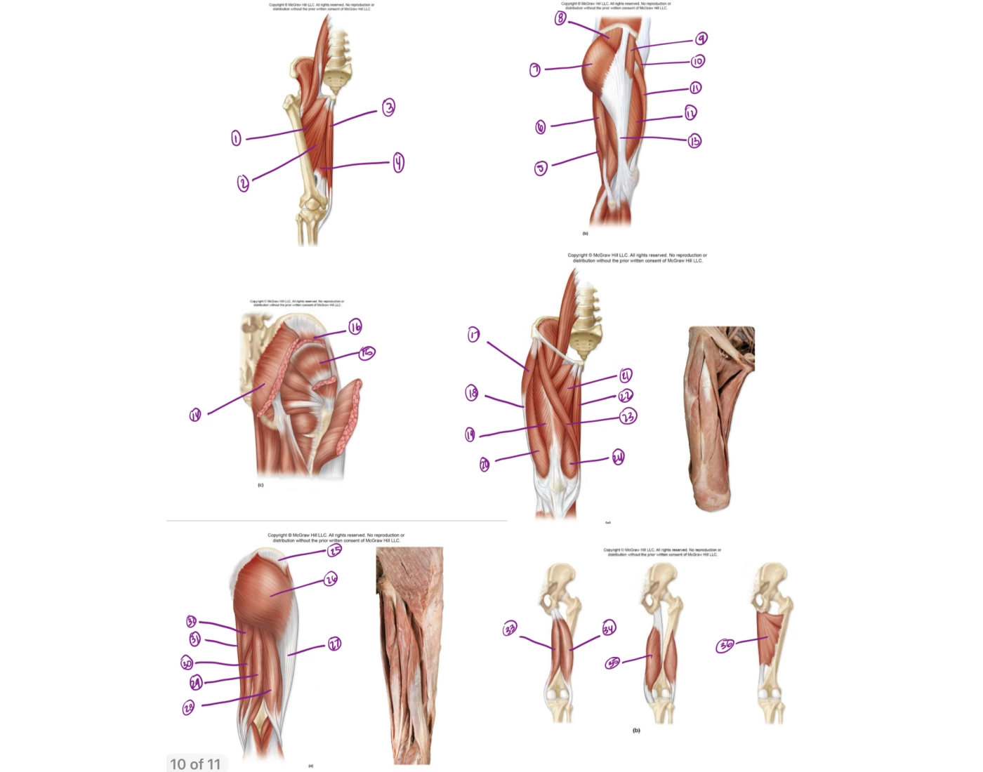 Proximal Muscle Example muscles of proximal leg Quiz