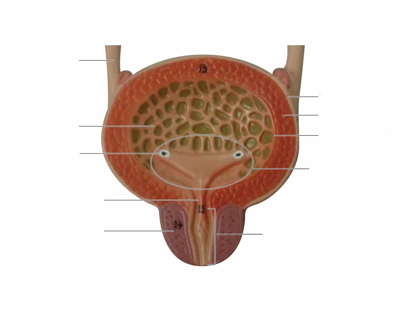 Endoscopic Bladder Model Bladder model Quiz