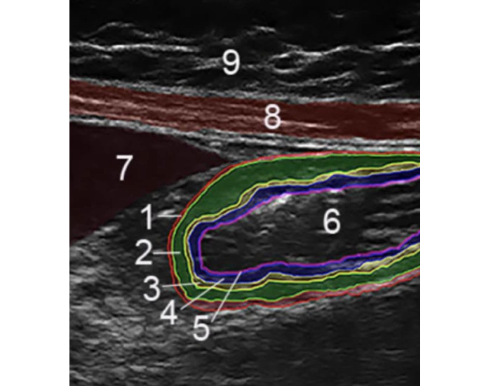 POCUS: Layers of gastric wall — Printable Worksheet