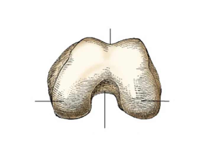 Distal Knee: Inferior Surface — Printable Worksheet