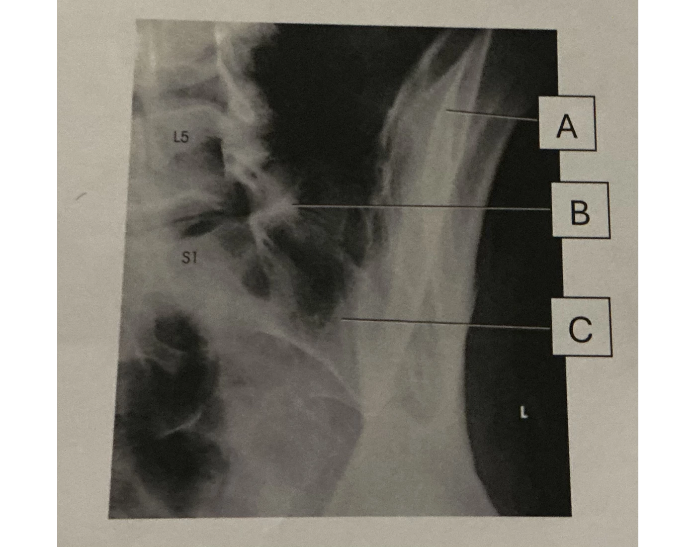 Si Rpo RPO SI Joints Quiz