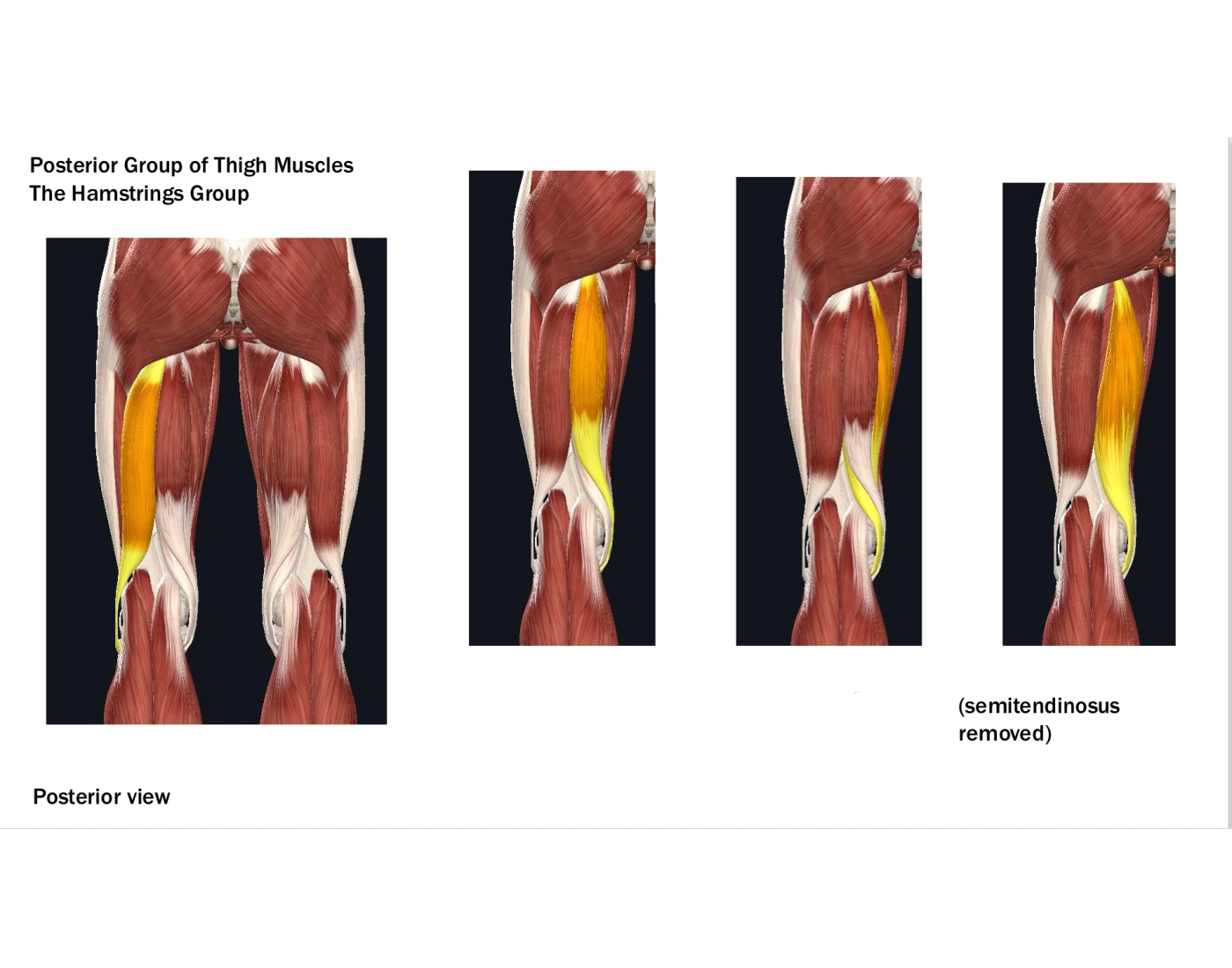 The Hamstrings Group of Muscles — Printable Worksheet