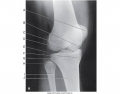 Internal Oblique Knee Radiograph
