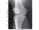 External Oblique Knee Radiograph