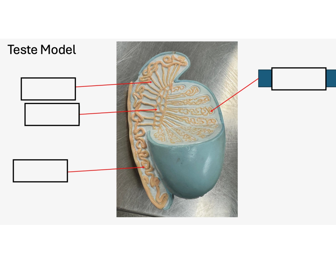 Teste Model Quiz
