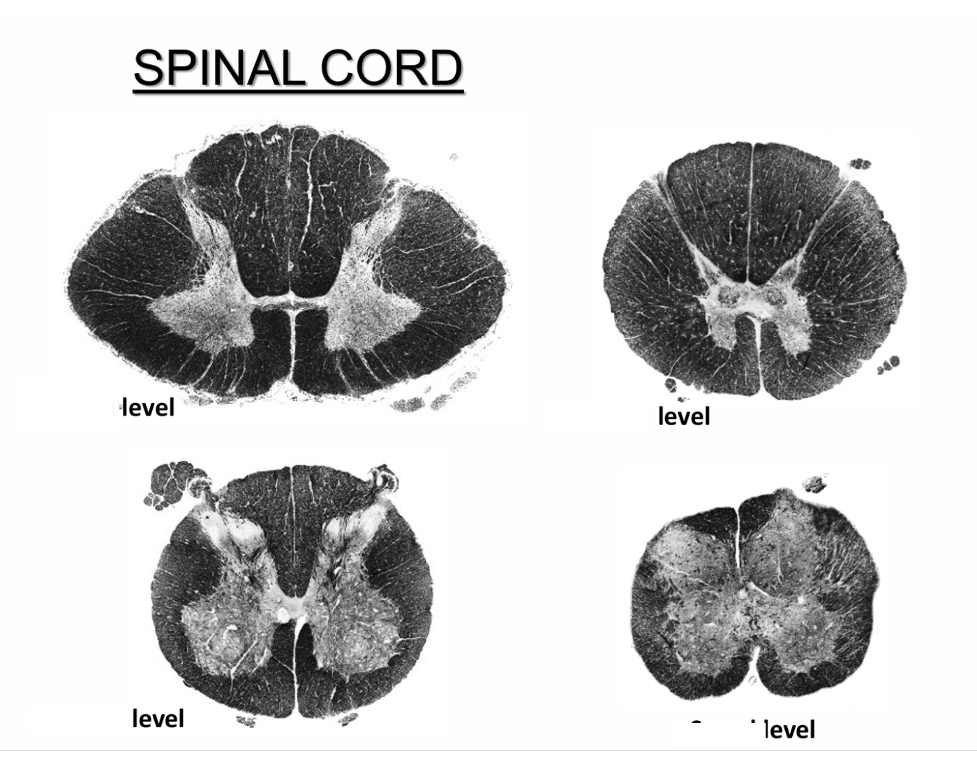 Semi Rigid Spine Levels Spinal Cord Levels Quiz