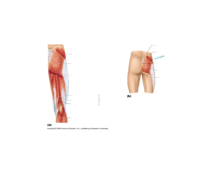 Pelvic/Hip/Thigh Muscles on Right Side Quiz Pelvic/Hip/Thigh Muscles on Right Side Quiz