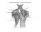 Muscles of the posterior shoulder and back