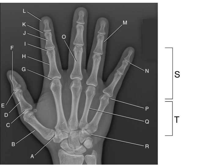 Left Hand Projection Hand Projection Quiz