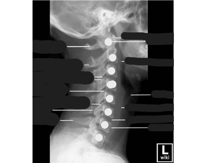 Lateral x ray image — Printable Worksheet