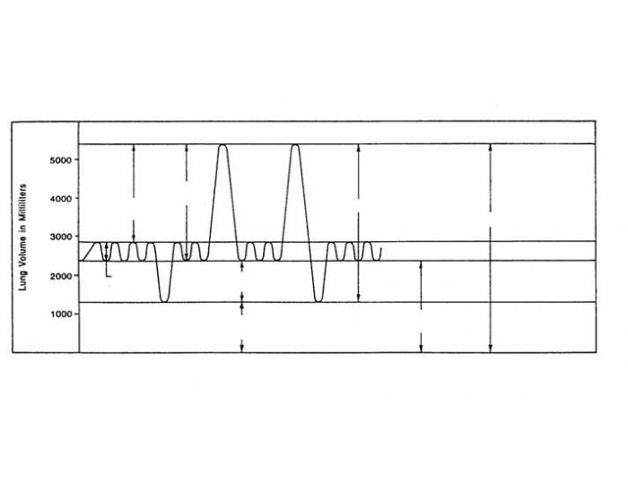 Spirometry Graph Unlabeled at Nancy Hutchinson blog