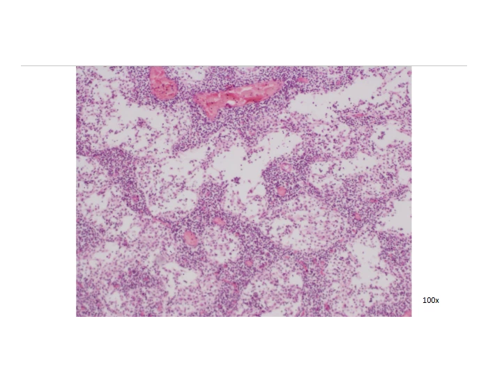 Lymph node medulla Quiz