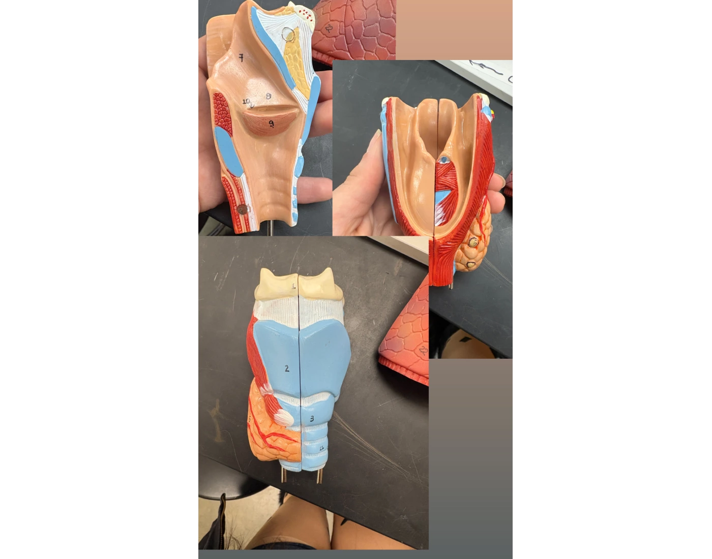 larynx labeled — Printable Worksheet