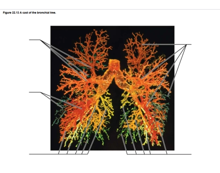ch 22 bronchial tree cast — Printable Worksheet