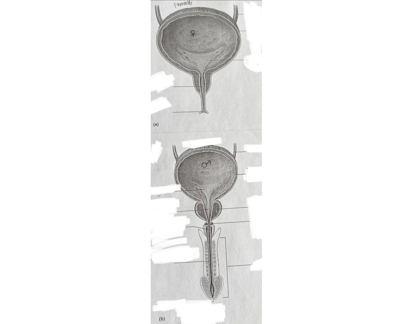 Bladder Game urinary bladder both genders Quiz