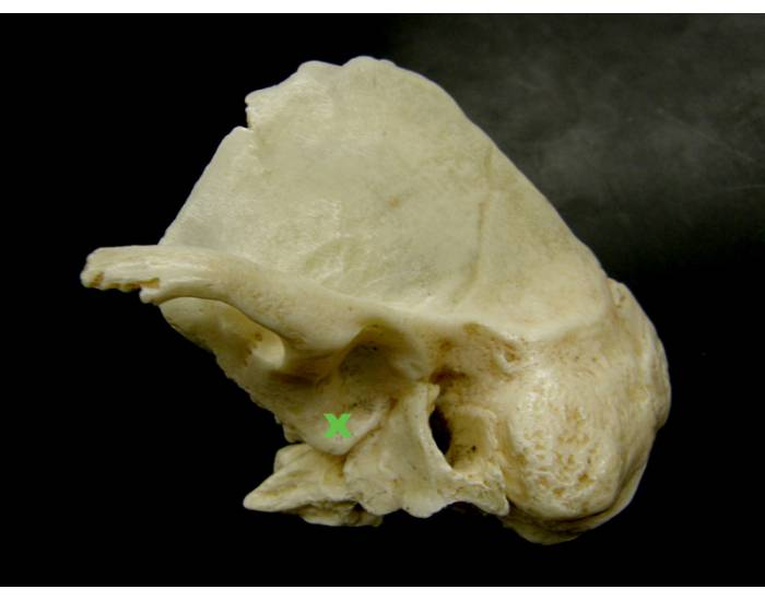Exploded Temporal Bone Quiz