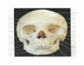 Human Skull: Anterior