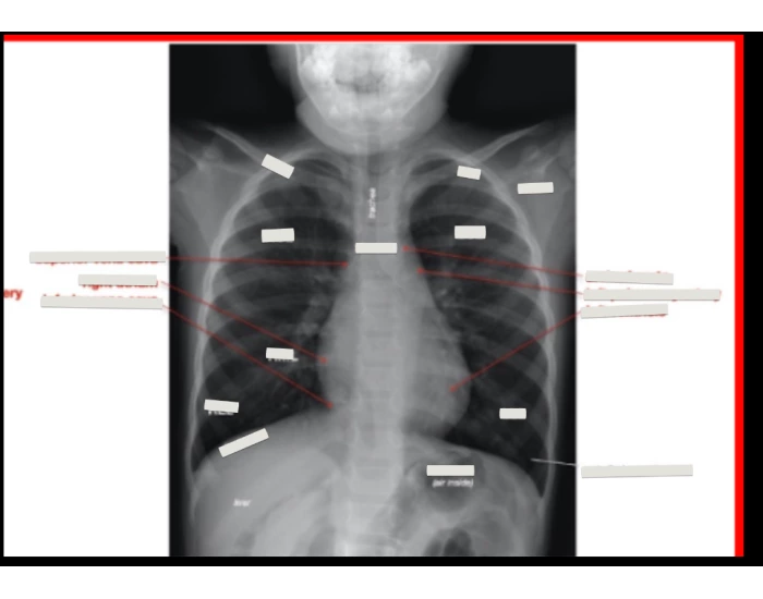 Lab 1 xray of chest Quiz