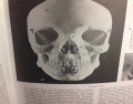 Cranium Osteology 1