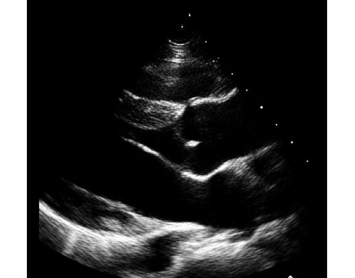 Label Peristernal long axis view Quiz