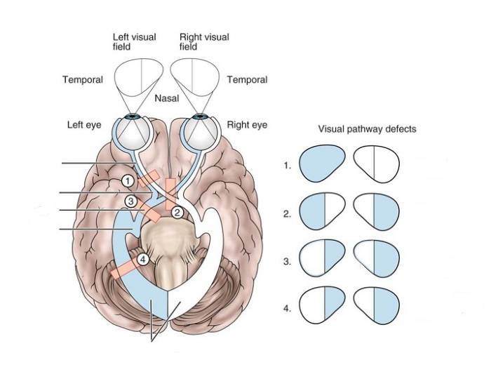 The visual pathway Quiz