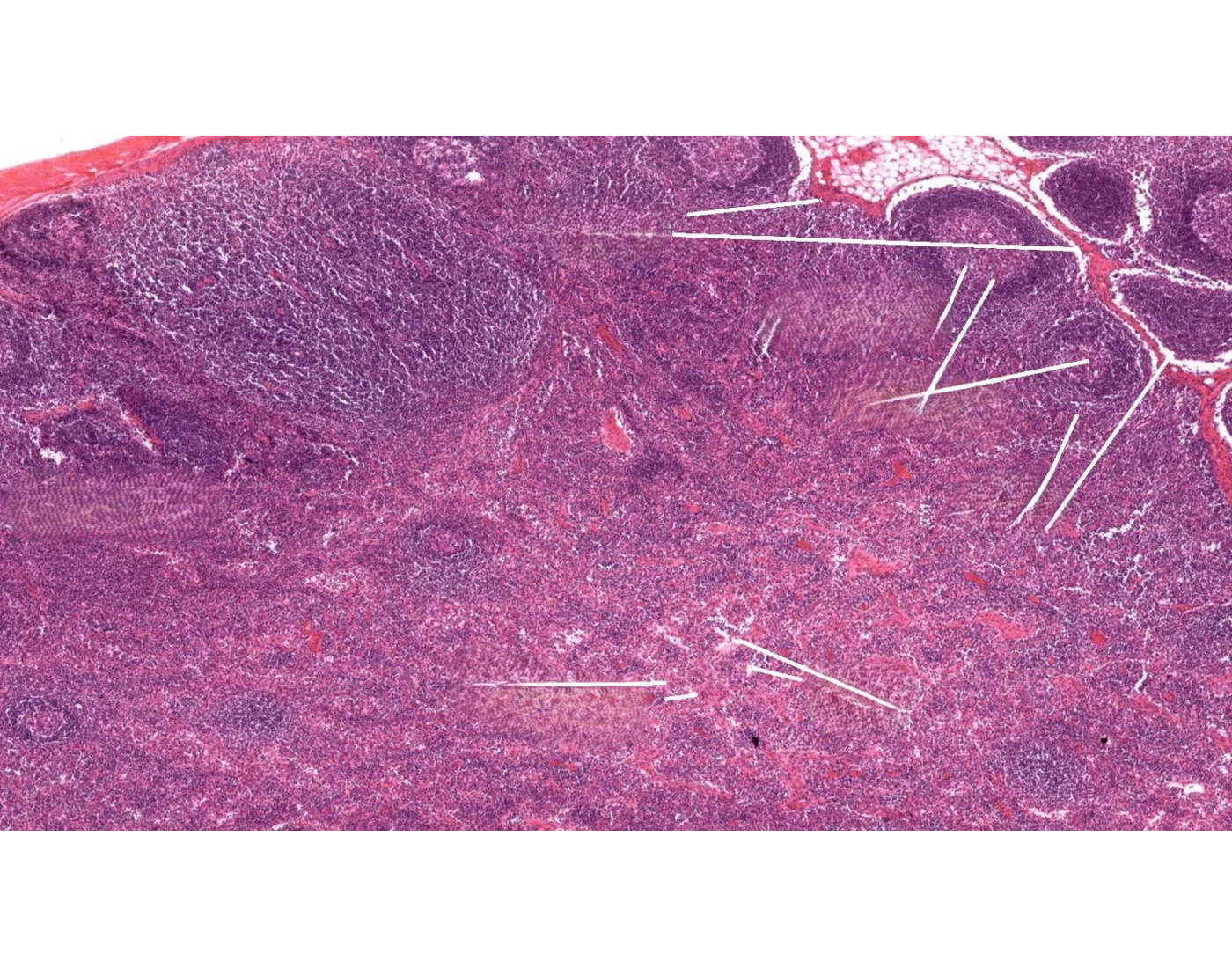 Lymph System Worksheet Lymph identification histology — Udskrivbart Arbejdsark