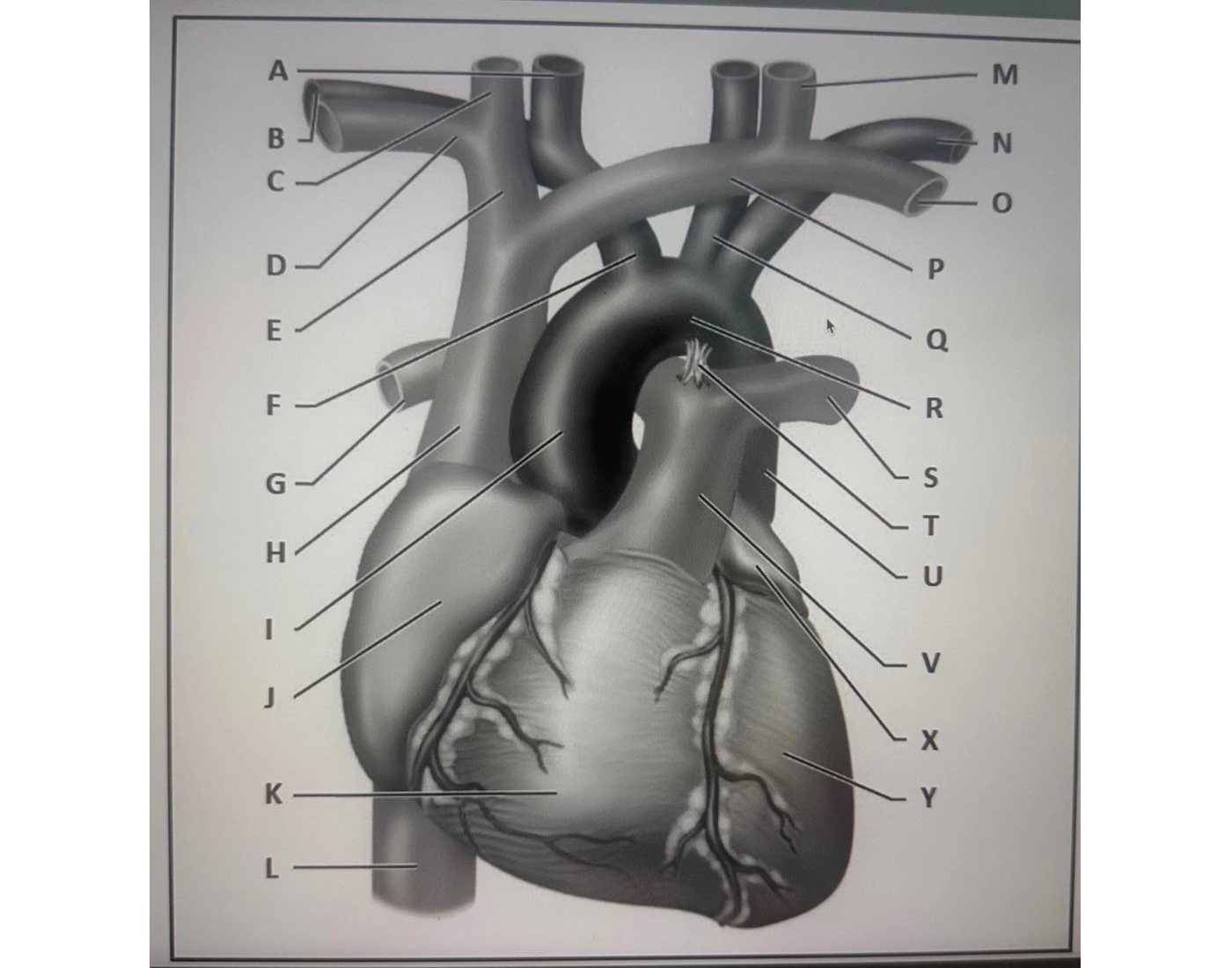 Digective System Worksheet Great vessels: heart — Printable Worksheet