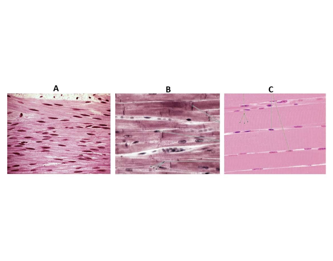 Musclar System Types Three Types of Muscle Tissue, microscopic slides — Printable Worksheet