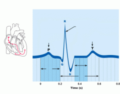 Electrokardiogram (EKG)