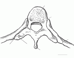 Thoracic Vertebra Axial Diagram