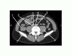 Pelvis (CT Axial Soft Tissue 1 of 14)