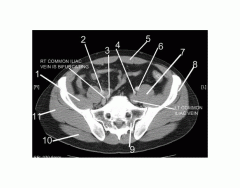 Pelvis (CT Axial Soft Tissue 5 of 14)