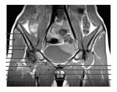 Pelvis (MRI Coronal 1 of 2)