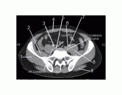 Pelvis (CT Axial Soft Tissue 4 of 14)