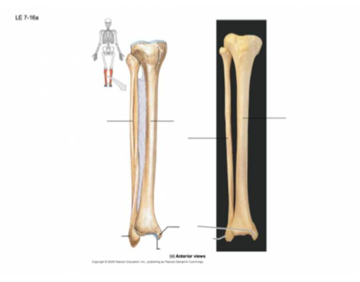 Tibia and Fibula (Lower Leg) — Printable Worksheet