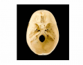 Skull, internal view of base