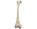 The Appendicular Skeleton - Femur (Posterior)