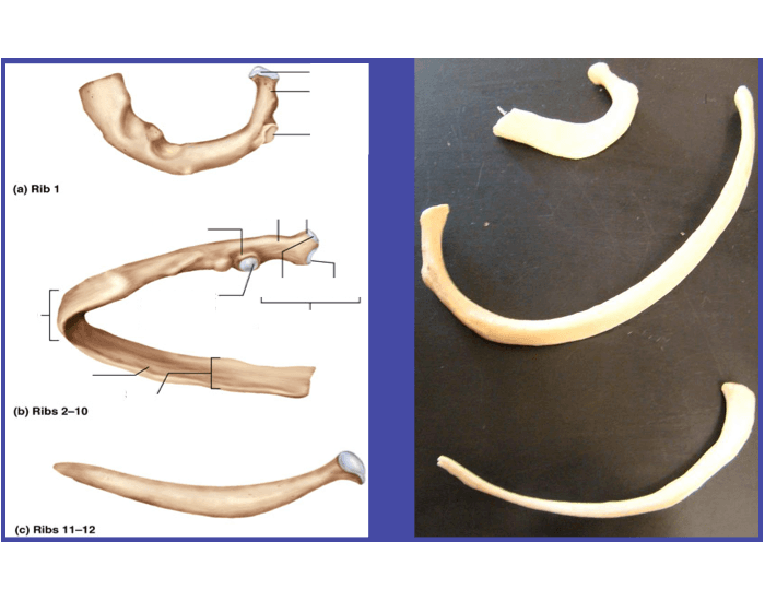 Ribs Picture and Lab Model Quiz
