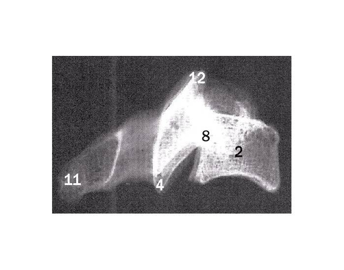 C4 LATERAL VIEW Quiz