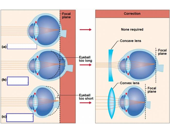 Problems of refraction Quiz
