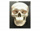 Anterior Skull