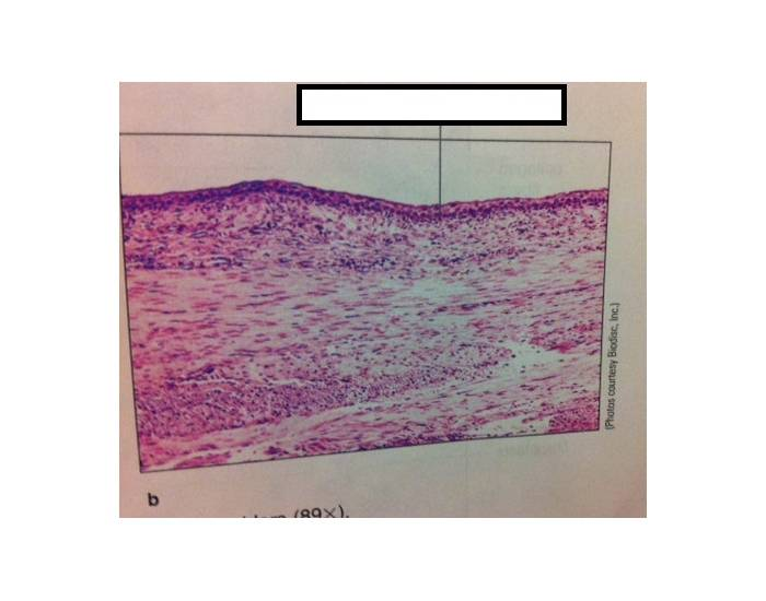 Section Of Distended Urinary Bladder 89X Quiz Section of distended urinary bladder 89x quiz