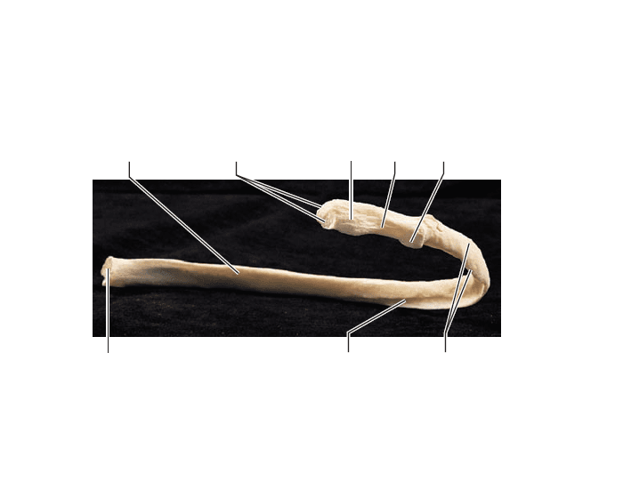 R Rib R Rib 6--Posterior View Quiz
