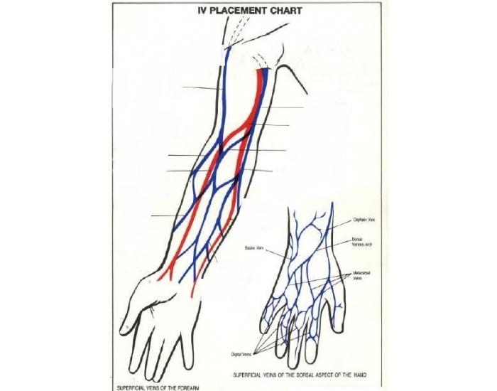 Iv Placement IV Placement Chart Quiz