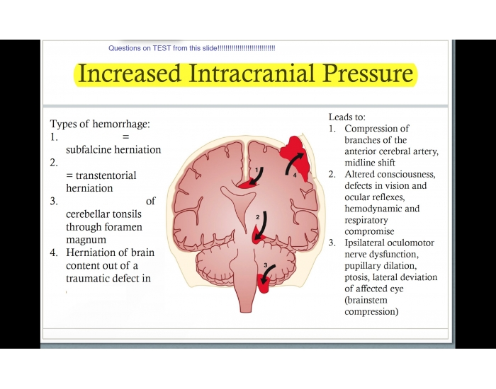 Types Of Hemorrhage Quiz Types Of Hemorrhage Quiz