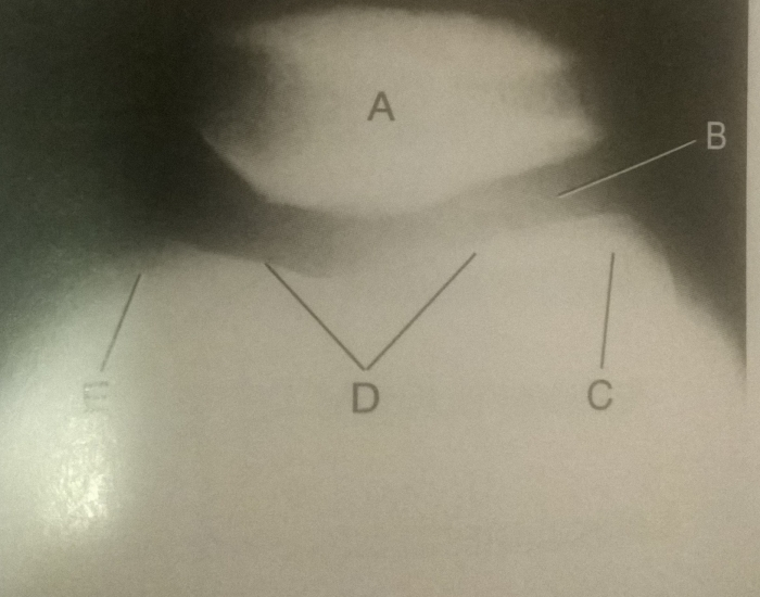 Tangential Projection Radiograph Tangential projection of knee. radiograph Quiz