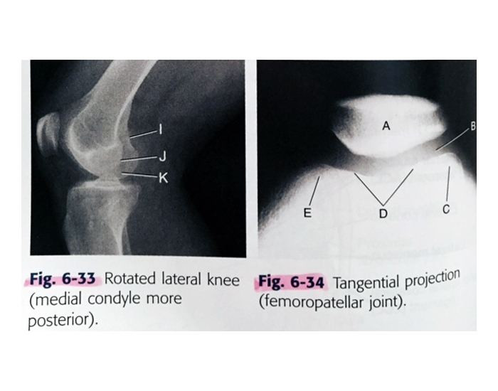 Tangential Projection Radiograph Lateral & Tangential Knee Projections Quiz