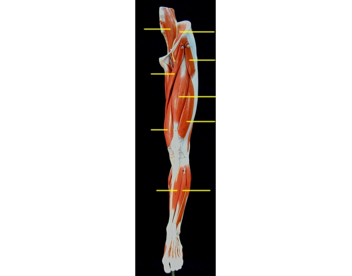 Upper Leg muscles anterior view Quiz