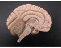 Small Brain Model - Sagittal Section - KKNAPP 2015