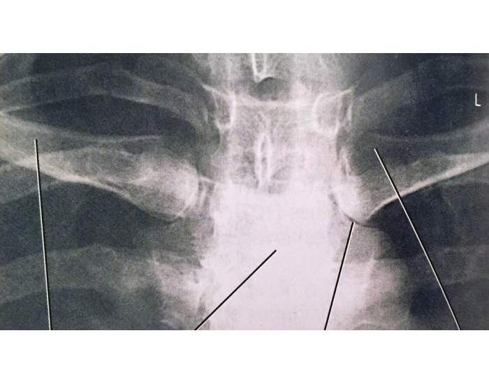 Sc Joint Testing SC Joints Quiz